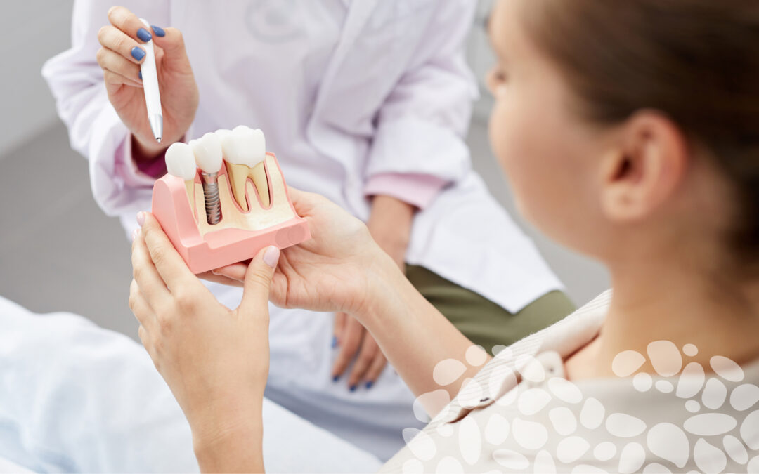 Understanding dental implants.